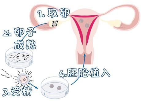 供卵孕妈带怀服务机构生殖中心